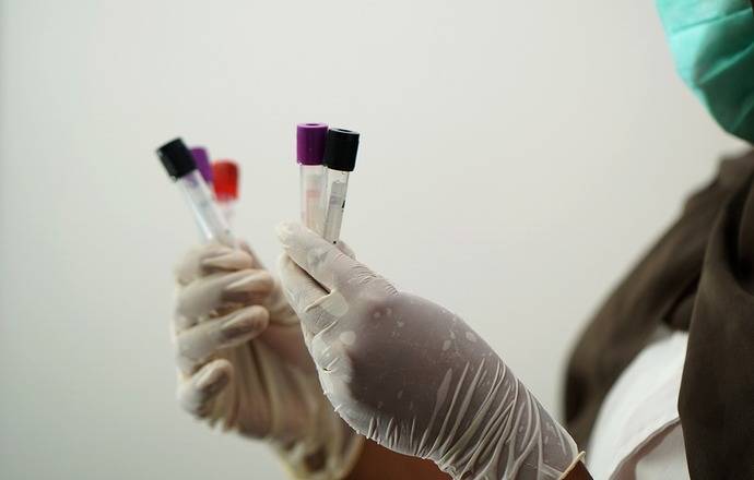 BioMaxima wprowadza do oferty test na koronawirusa, a giełda szaleje